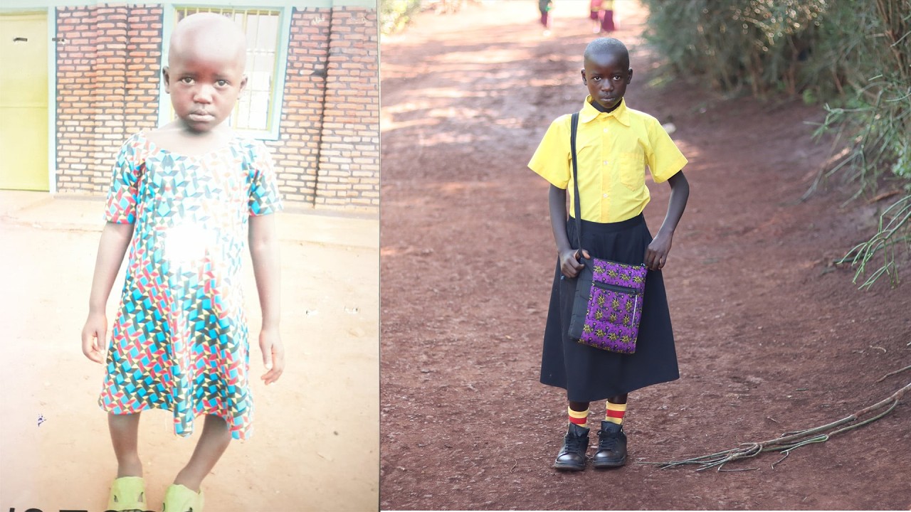 Empowering Children with Disabilities: How Advocacy Changed Alice’s Life in Eastern Rwanda