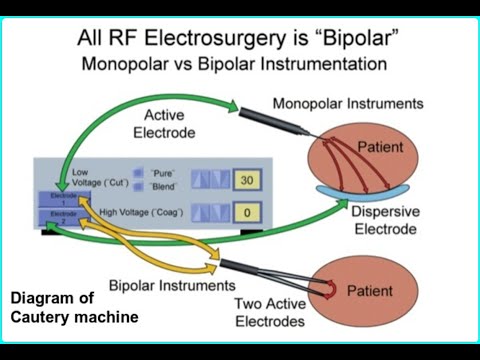 What is a Cautery Machine Working Principle of Cautery How to Work Uses of Cautery
