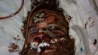 Officers on Trial in Killing of Kelly Thomas