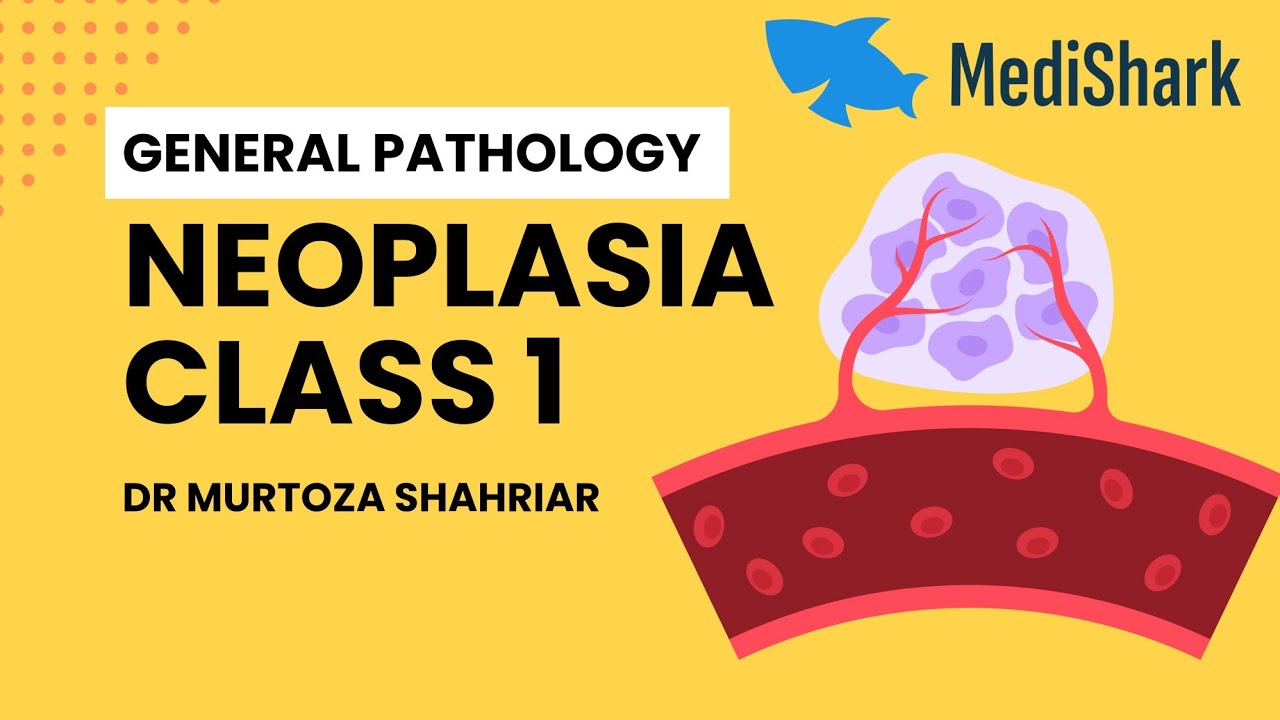 General Pathology. Neoplasia. Class 1