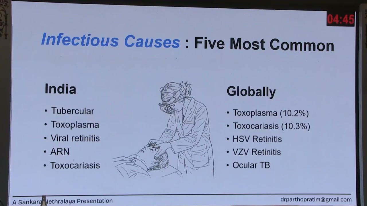 Posterior Uveitis in Children
