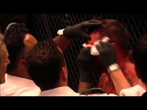 BAMMA 6: Frank Trigg vs John Phillips