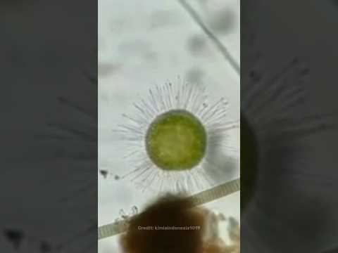 Covid under the microscope😳| #shorts