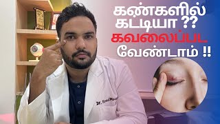 Download lagu கண்களில் கட்டியா ?? கவலைப்பட வேண்டாம் !! | Tamil | Dr. Syed Moosa | Eye Doctor | mp3 Download lagu கண்களில் கட்டியா ?? கவலைப்பட வேண்டாம் !! | Tamil | Dr. Syed Moosa | Eye Doctor | mp3