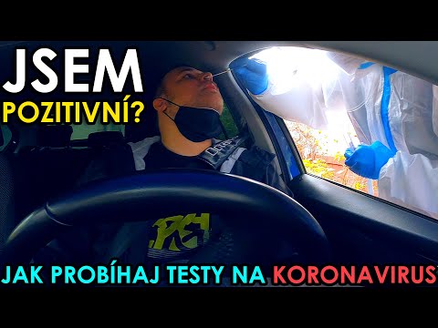 JAK PROBÍHAJ TESTY NA KORONAVIRUS A JSEM POZITIVNÍ? (+ SOUTĚŽ O 150 CEN ZA 130 TISÍC) - WEEK #236