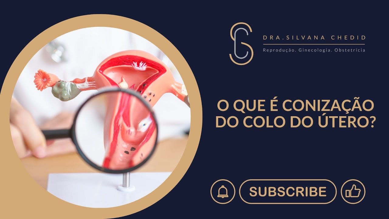 O que é conização do colo do útero?