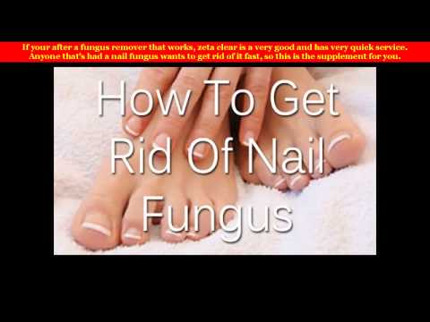 Dilaw toenails folk remedyo sa paggamot Bitamina complex para sa paggamot ng kuko