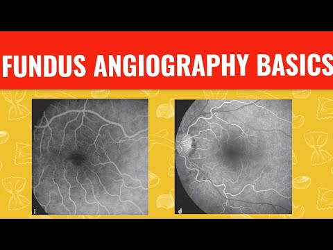 FFA-Kurs || FUNDUS-FLUORESZEIN-ANGIOGRAPHIE ||