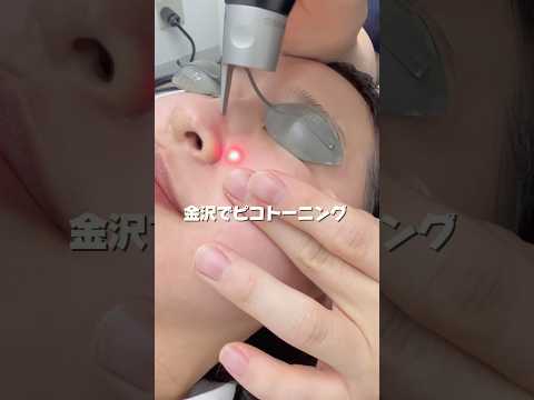 I had pico toning done in Kanazawa 😻 My blemishes are gone and my skin is so clear, and I'm happy...