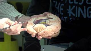 preview picture of video 'Neuroanatomy - Part1'