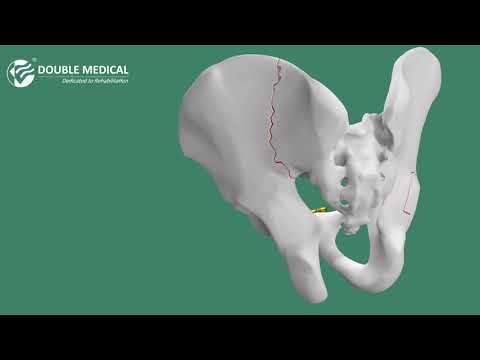 Double Medical Complete Pelvic Fracture Treatment Solutions