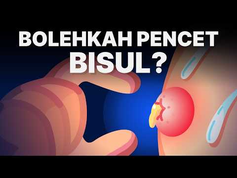 Apa yang Terjadi Saat Bisul Dipencet?