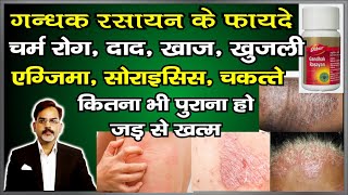 दाद खाज खुजली, सोराइसिस, एग्जिमा जड़ से ख़त्म | Gandhak Rashayan Benefits