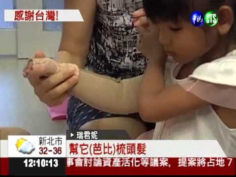 台灣醫療團幫忙 象臂女孩變美了!
