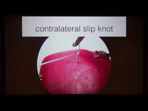 Square knot, Slip knot and Surgeon's knot