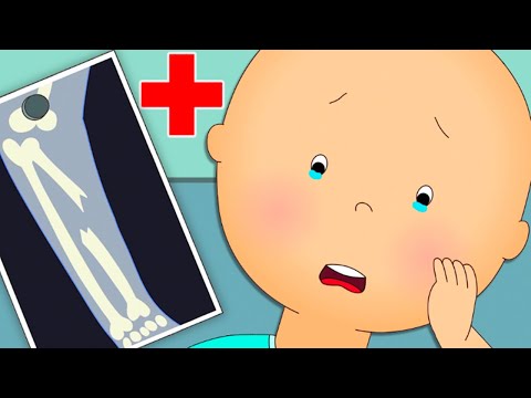 Caillou’s Broken Bone | Caillou Cartoon