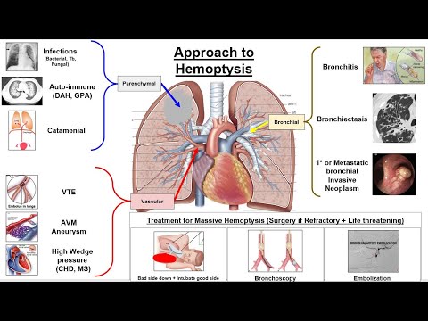 TMAR: Approach to Hemoptysis