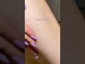 How I M Removing My Leg Hair This Summer Epilator Hairremoval Shorts
