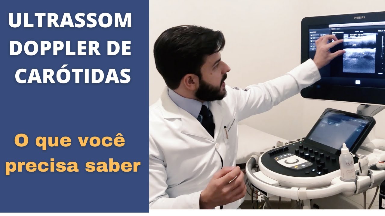 Ultrassom Doppler de Carótidas - o que você precisa saber!