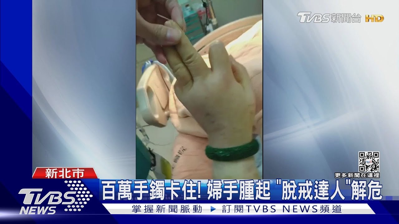 百萬手鐲卡住！婦手腫起　「脫戒達人」解危