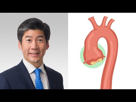 Surgeon Q&A: What Are Annual Growth Rates for Aortic Aneurysms?