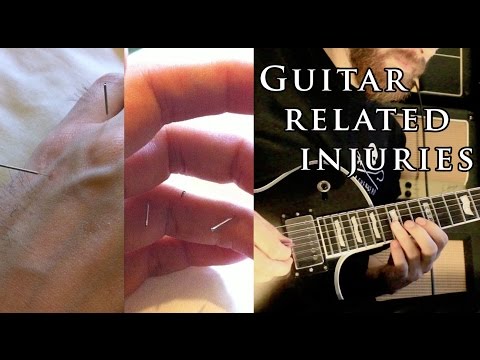 Guitar Related Injuries (RSI, tendonitis, ligament damage etc) - Josh Middleton