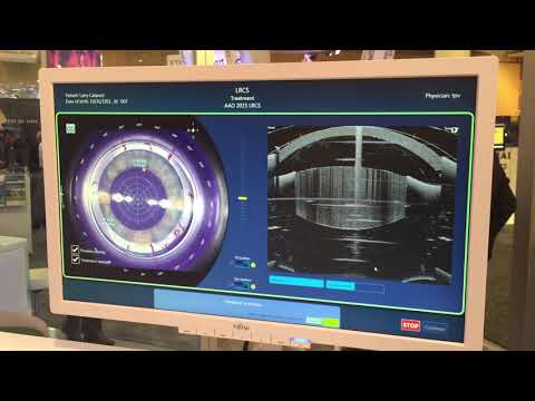 SimulEYE FEMTO | Bausch + Lomb Victus