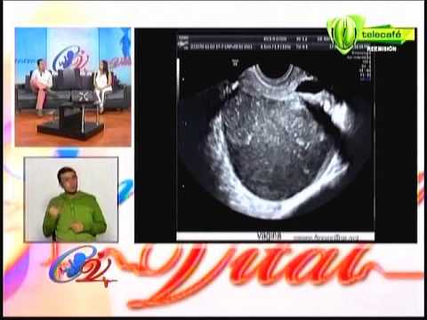 Oncología en la ginecología (Dra. Paula Gallego) - 30-JUL-2014