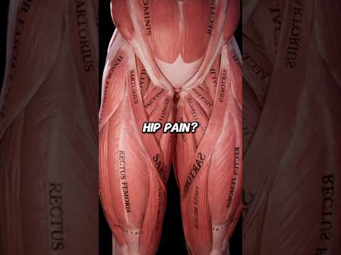 How To Fix Hip Pain (IMPINGEMENT)