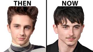Plastic Surgeon Reacts To Timothee Chalamet's NEW FACE