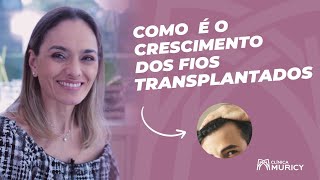 Entenda como funciona o crescimento dos fios transplantados