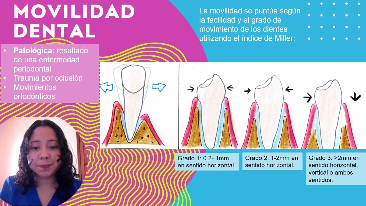 Métodos de diagnostico periodontal