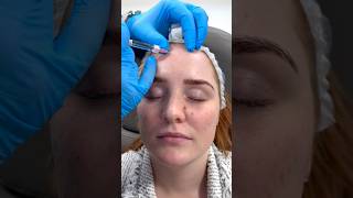 Download lagu Skin booster treatment at Dr. Medispa mp3