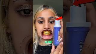 Ela mudou a cor de seus dentes!😬🪥🦷