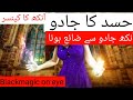 Hasad Ka Jadu Ankh Pe Jadu Aur Ilaj Blackmagic On Eyes آنکھ پے جادو RukiyaQurani Drhafiz U