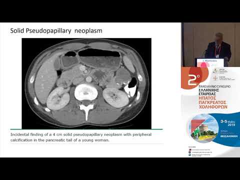 Grutzmann R. - The role of vascular resections in pancreatic cancer treatment
