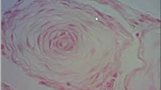 Corpúsculo de Paccini