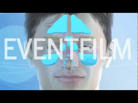 EVENTFILM FESS Functional endoscopic sinus surgery