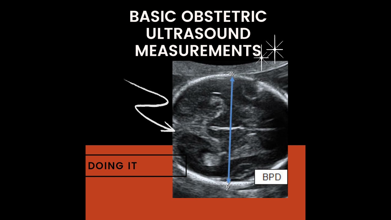 Basic obstetric ultrasound measurements. You can order for you PDF now.