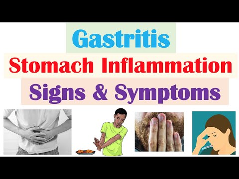 Gastritis (Stomach Inflammation) Signs & Symptoms, Complications (& Why They Occur)