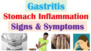 Gastritis (Stomach Inflammation) Signs & Symptoms, Complications (& Why They Occur)