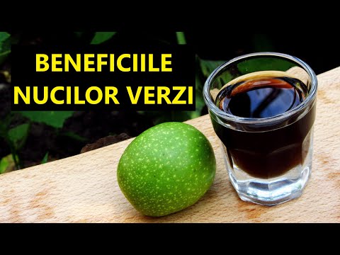 asparks în revizuirile venelor varicoase prevenirea exerciiilor în varicoza
