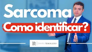Sarcomas. Como identificar? Quais os sinais e sintomas dos sarcomas ?