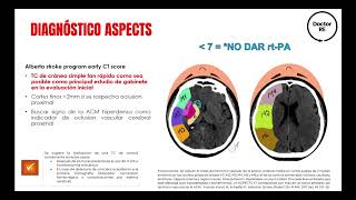 ISCHEMIC AND HEMORRHAGIC STROKE ENARM