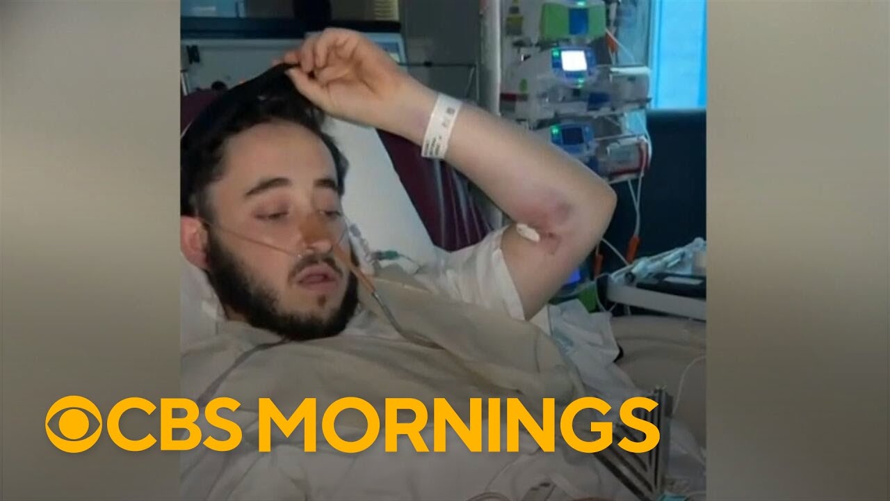 American wounded in Bondi Beach shooting while volunteering at Hanukkah event