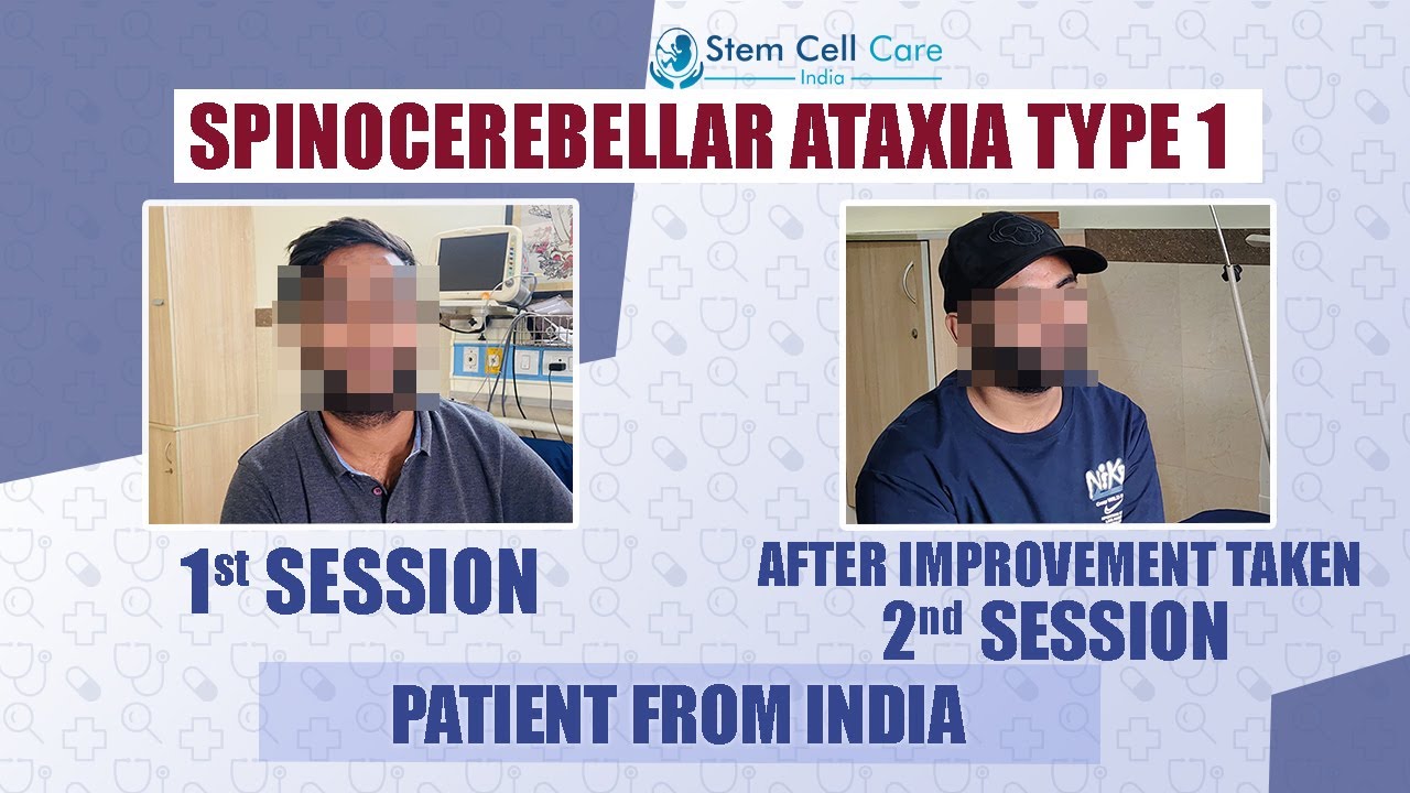 Indian Patient Shares His Journey After 1st & 2nd Stem Cell Sessions for Spinocerebellar Ataxia-1