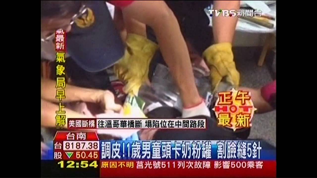調皮!1歲男童頭卡奶粉罐 割臉縫5針