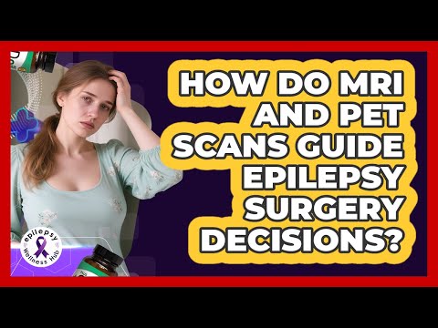 How Do MRI And PET Scans Guide Epilepsy Surgery Decisions? - Epilepsy Wellness Hub