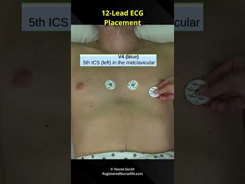 12-Lead ECG / EKG Electrode Placement for Nursing School Students & Nurses #shorts
