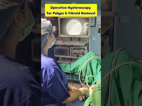 Operative Hysteroscopy for Polyps and Fibroids Removal, Hysteroscopic Polypectomy #drrakshitamalik